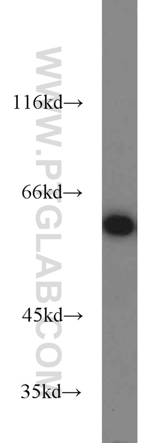 HDAC2 Antibody in Western Blot (WB)