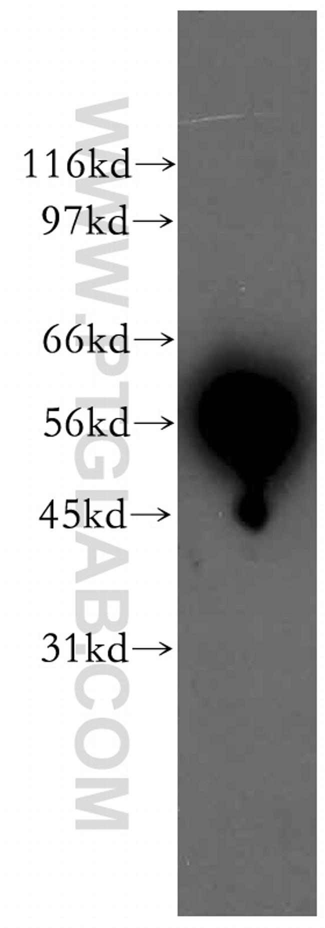 HDAC2 Antibody in Western Blot (WB)