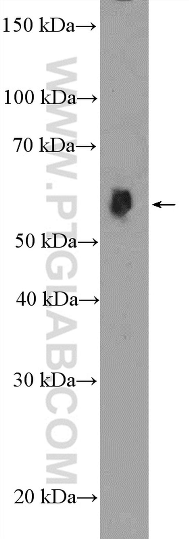 HDAC2 Antibody in Western Blot (WB)