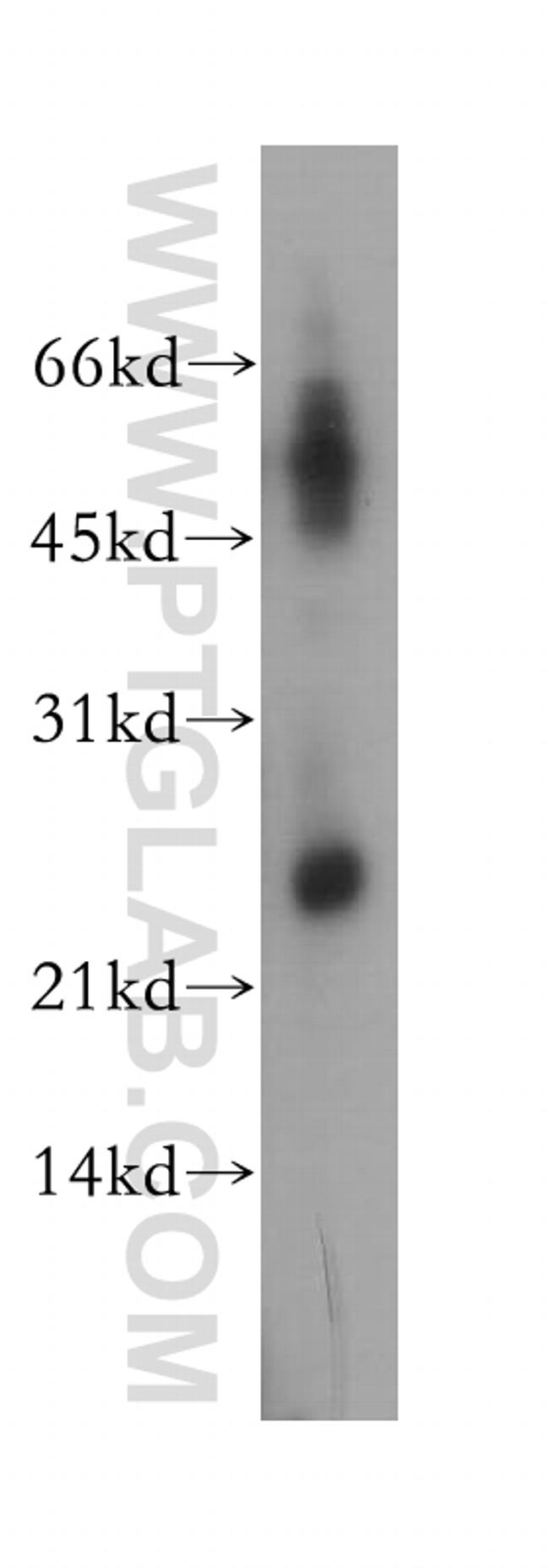 DUSP19 Antibody in Western Blot (WB)