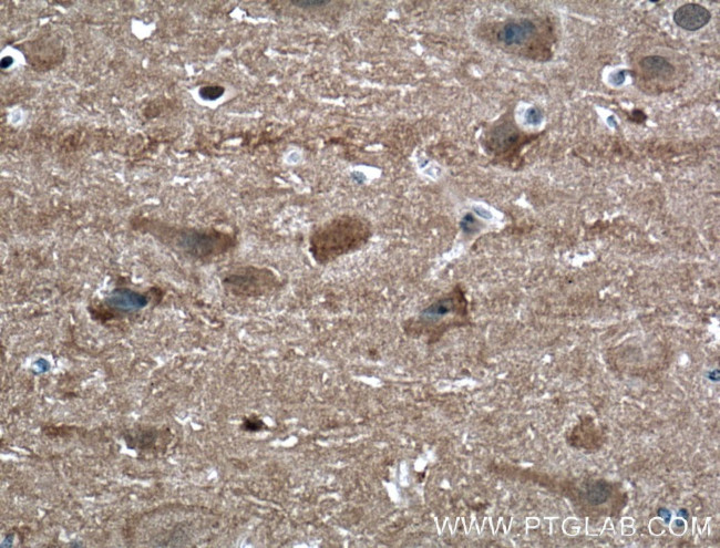 NCALD Antibody in Immunohistochemistry (Paraffin) (IHC (P))