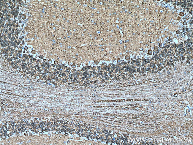 NCALD Antibody in Immunohistochemistry (Paraffin) (IHC (P))