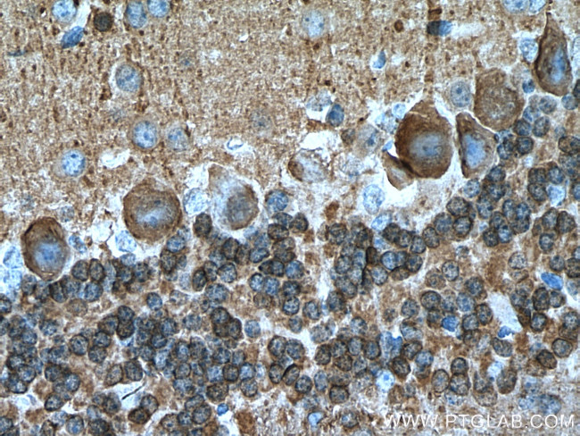 NCALD Antibody in Immunohistochemistry (Paraffin) (IHC (P))