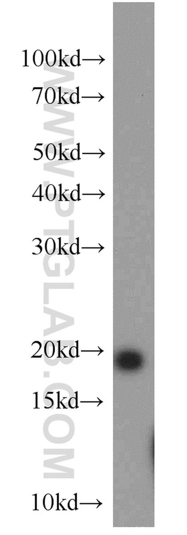 NCALD Antibody in Western Blot (WB)