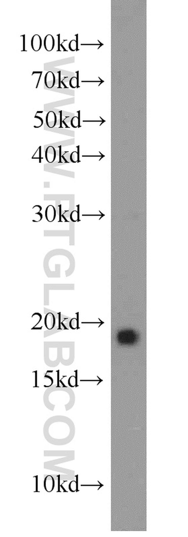 NCALD Antibody in Western Blot (WB)