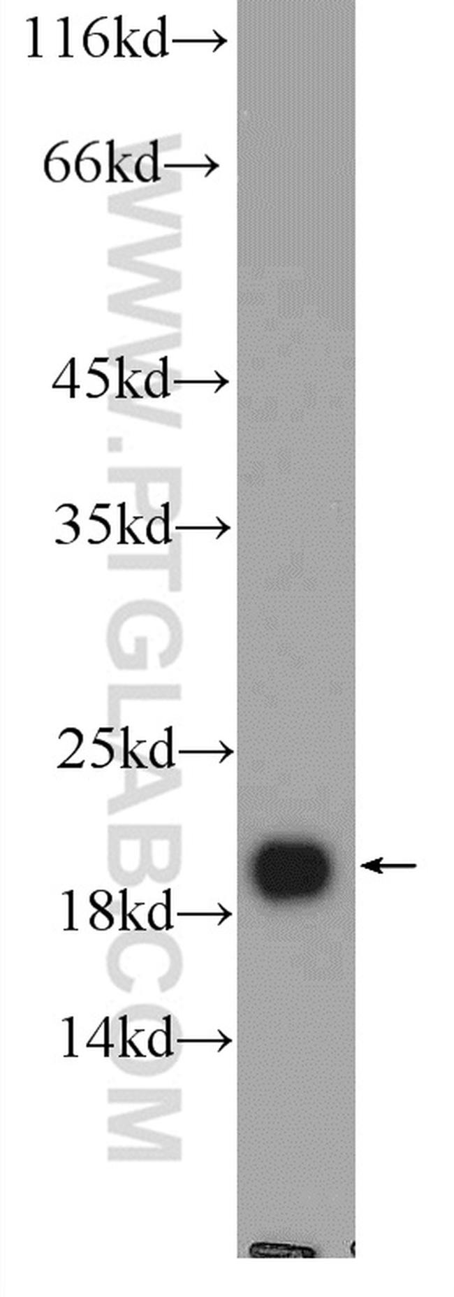 NCALD Antibody in Western Blot (WB)