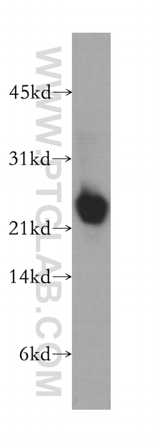 NCALD Antibody in Western Blot (WB)