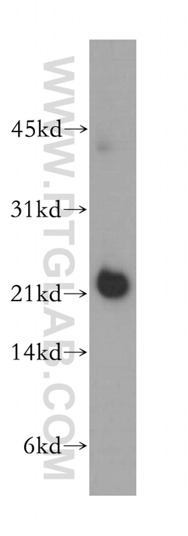 NCALD Antibody in Western Blot (WB)