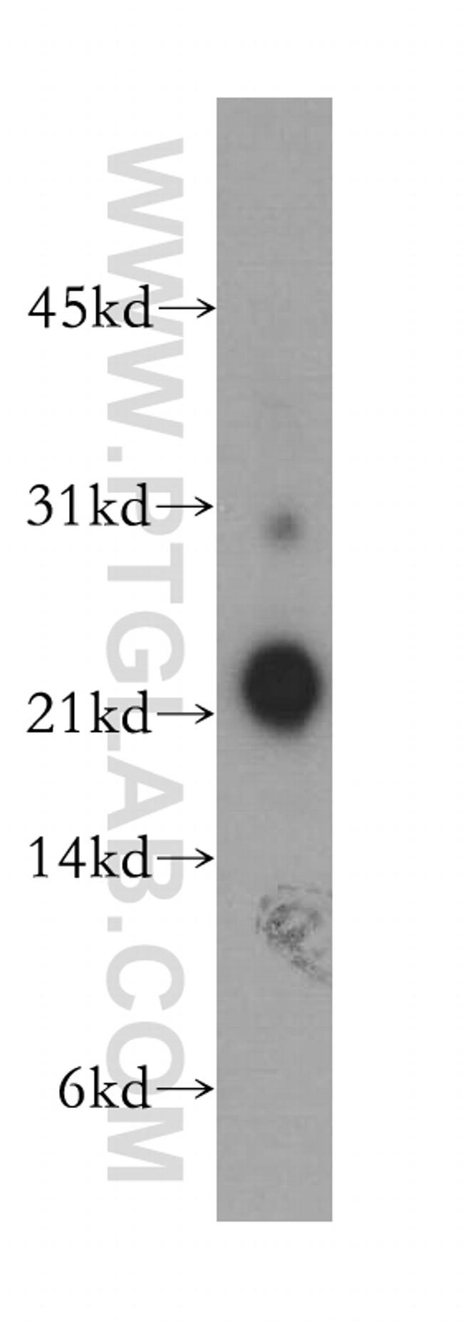 NCALD Antibody in Western Blot (WB)