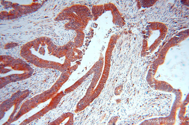 SKAP2 Antibody in Immunohistochemistry (Paraffin) (IHC (P))