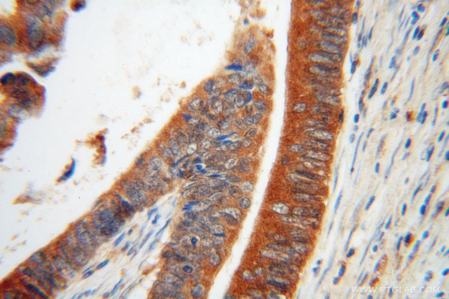 SKAP2 Antibody in Immunohistochemistry (Paraffin) (IHC (P))