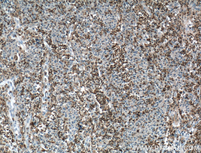 SKAP2 Antibody in Immunohistochemistry (Paraffin) (IHC (P))