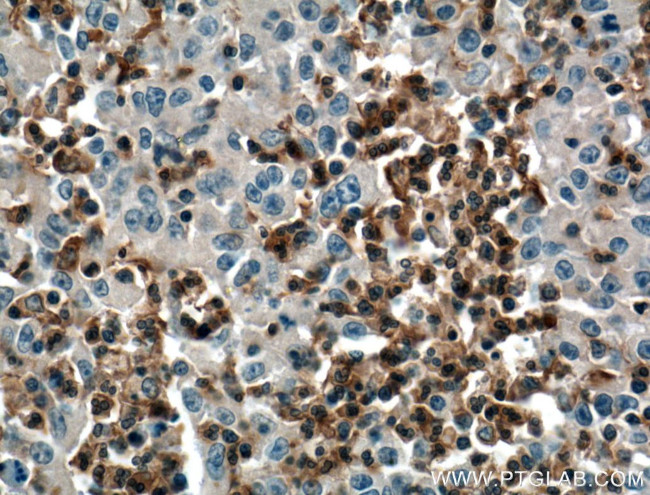 SKAP2 Antibody in Immunohistochemistry (Paraffin) (IHC (P))