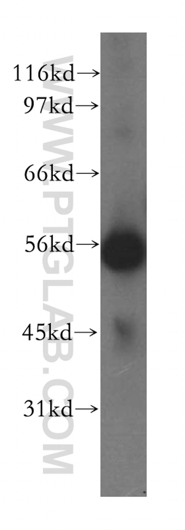 SKAP2 Antibody in Western Blot (WB)