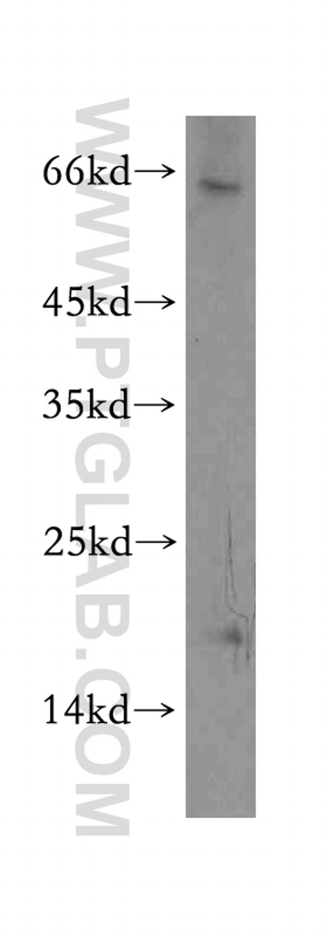 TXNL4B Antibody in Western Blot (WB)