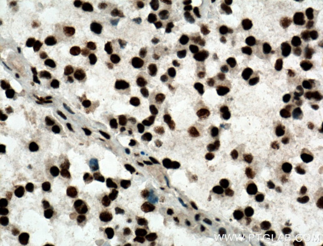 ASF/SF2 Antibody in Immunohistochemistry (Paraffin) (IHC (P))