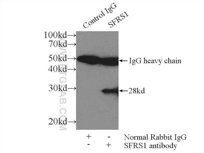 ASF/SF2 Antibody in Immunoprecipitation (IP)