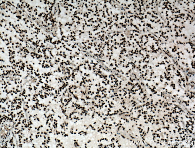 ASF/SF2 Antibody in Immunohistochemistry (Paraffin) (IHC (P))