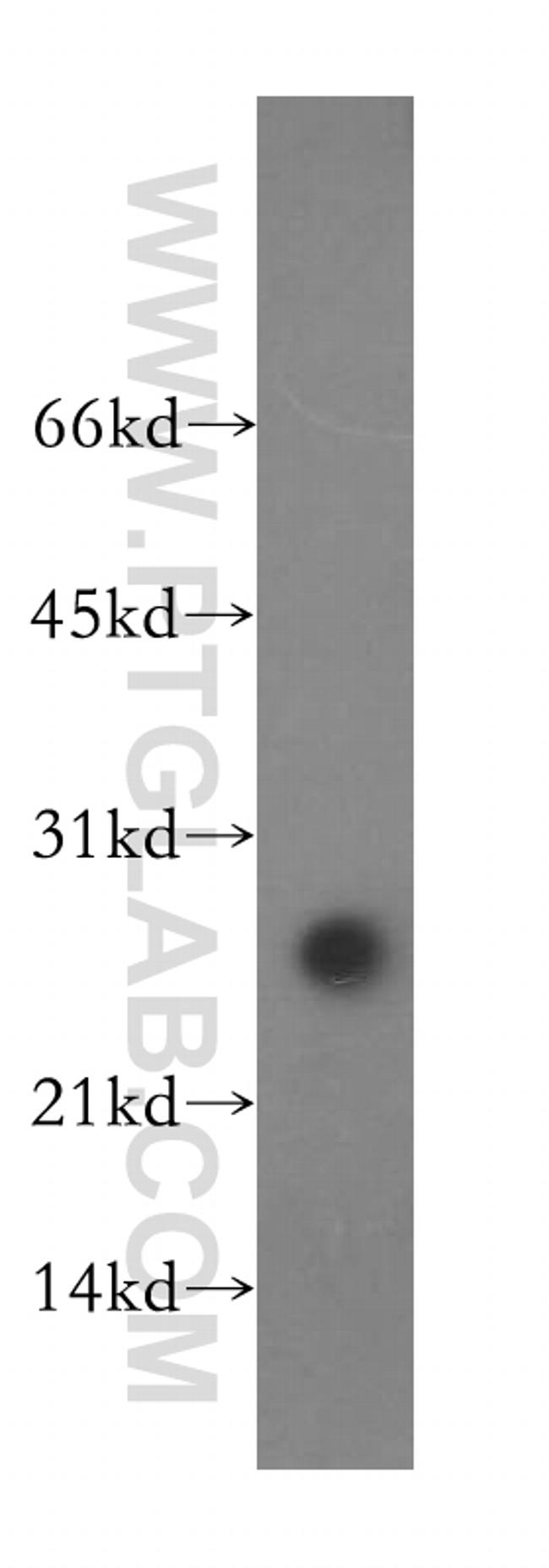 ASF/SF2 Antibody in Western Blot (WB)