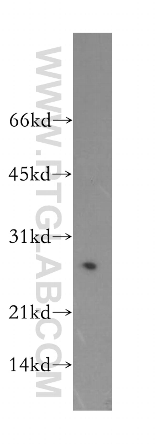 ASF/SF2 Antibody in Western Blot (WB)