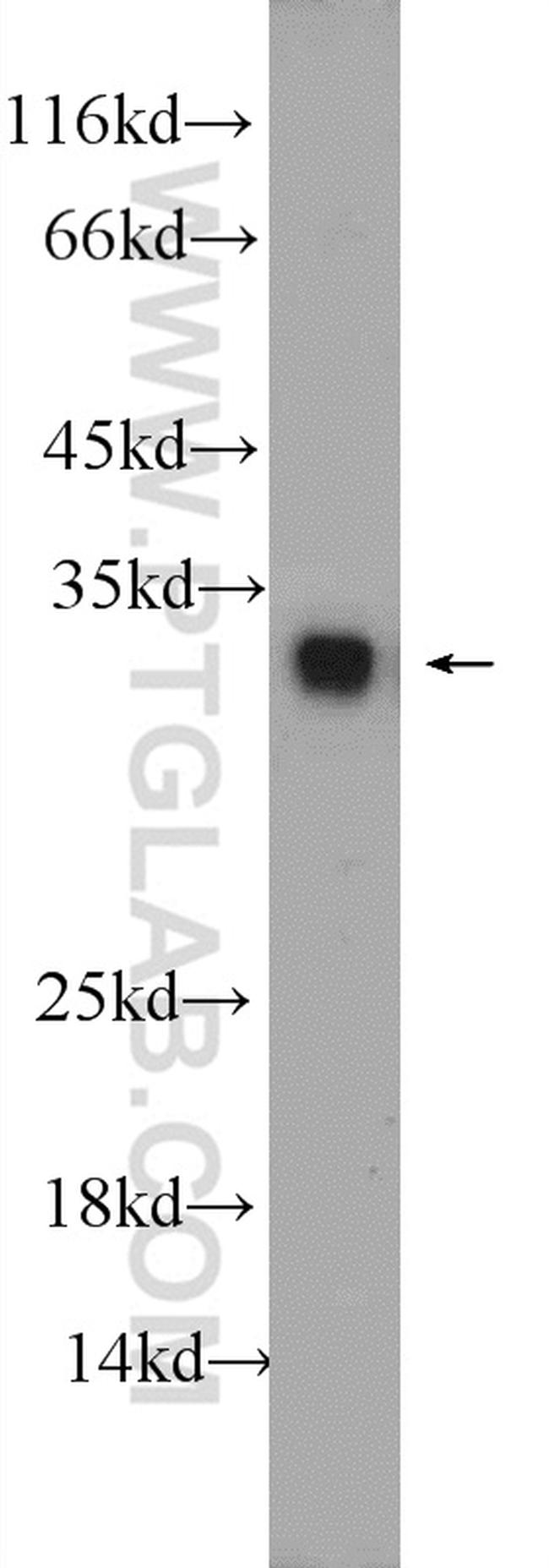ASF/SF2 Antibody in Western Blot (WB)