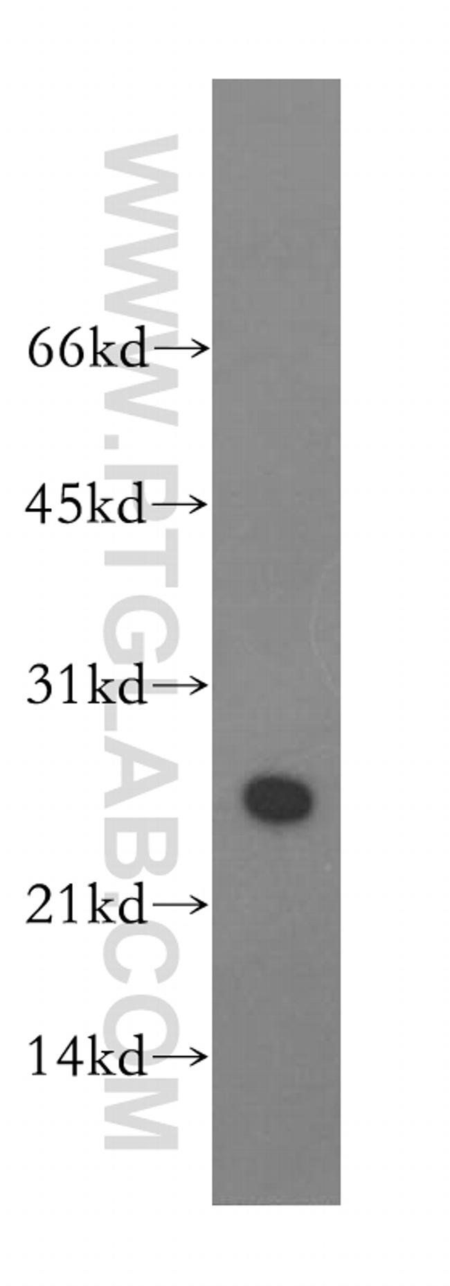 ASF/SF2 Antibody in Western Blot (WB)