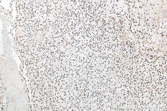 ASF/SF2 Antibody in Immunohistochemistry (Paraffin) (IHC (P))