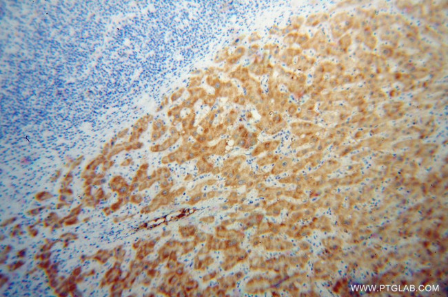 HRSP12 Antibody in Immunohistochemistry (Paraffin) (IHC (P))