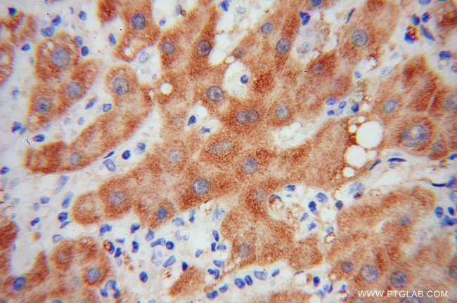 HRSP12 Antibody in Immunohistochemistry (Paraffin) (IHC (P))