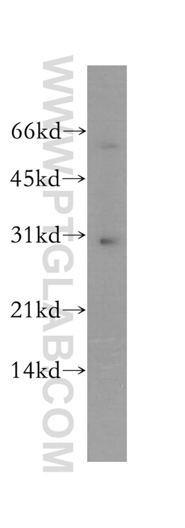 YIPF5 Antibody in Western Blot (WB)