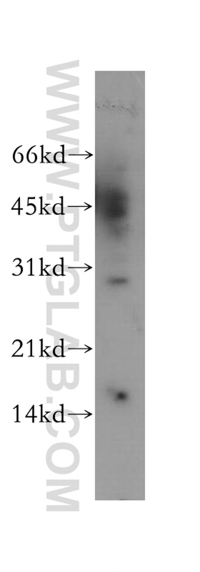 YIPF5 Antibody in Western Blot (WB)