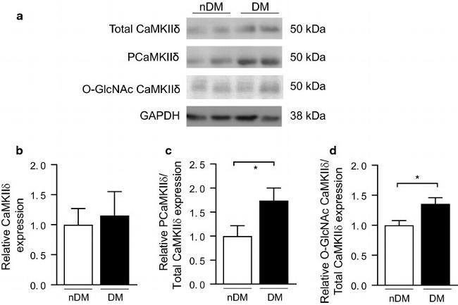 CaMKII delta Antibody in Western Blot (WB)