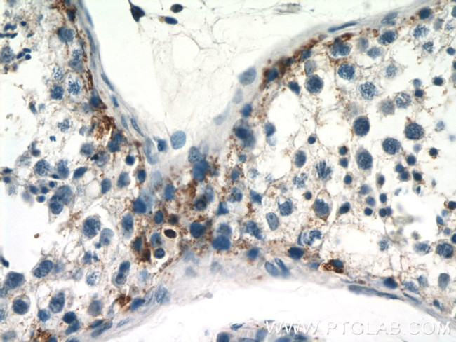 RASGAP Antibody in Immunohistochemistry (Paraffin) (IHC (P))