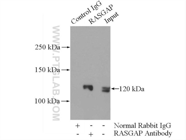 RASGAP Antibody in Immunoprecipitation (IP)