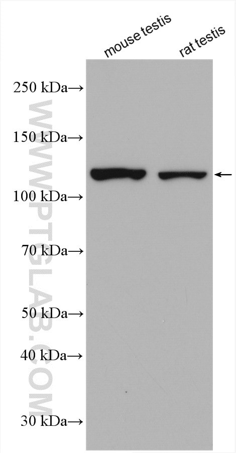 RASGAP Antibody in Western Blot (WB)