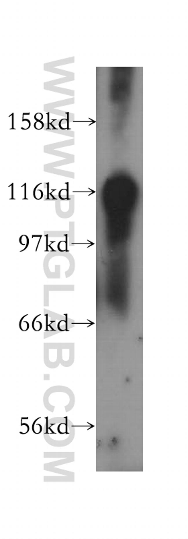 RASGAP Antibody in Western Blot (WB)