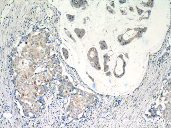 RASGAP Antibody in Immunohistochemistry (Paraffin) (IHC (P))