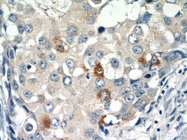 RASGAP Antibody in Immunohistochemistry (Paraffin) (IHC (P))