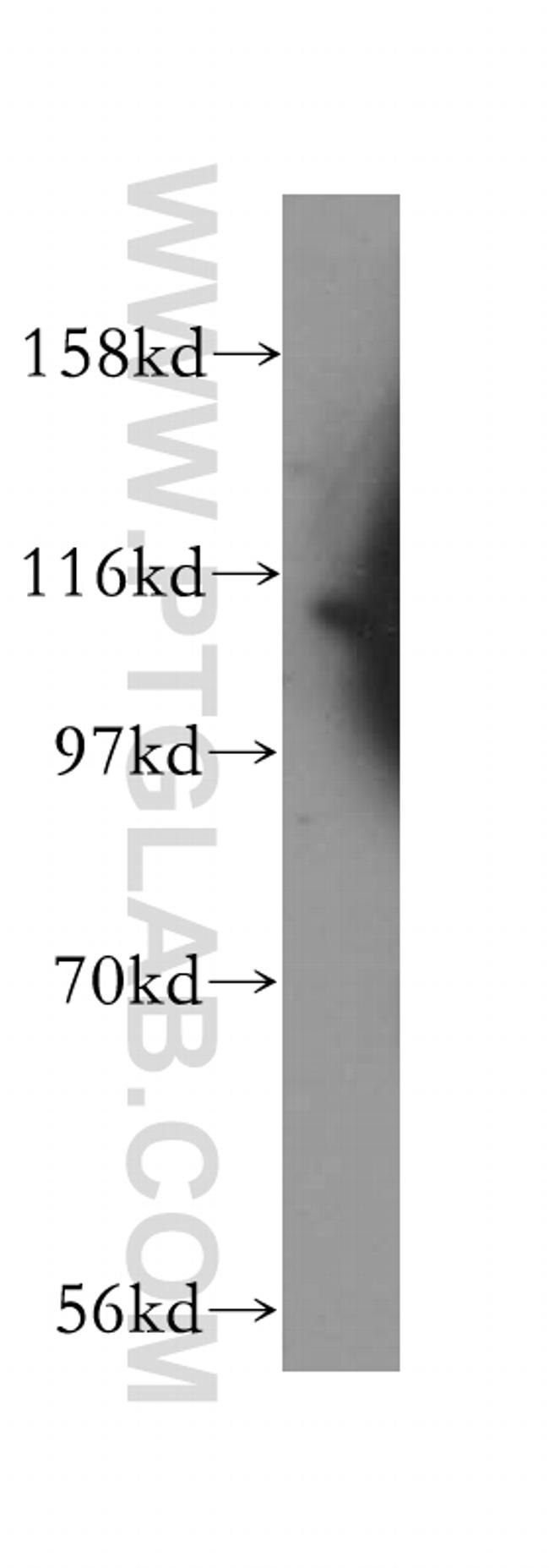 RASGAP Antibody in Western Blot (WB)