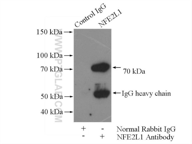 NFE2L1 Antibody in Immunoprecipitation (IP)