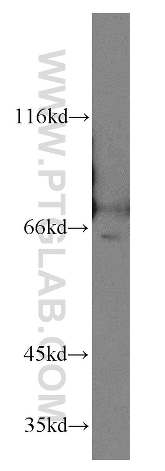 NFE2L1 Antibody in Western Blot (WB)