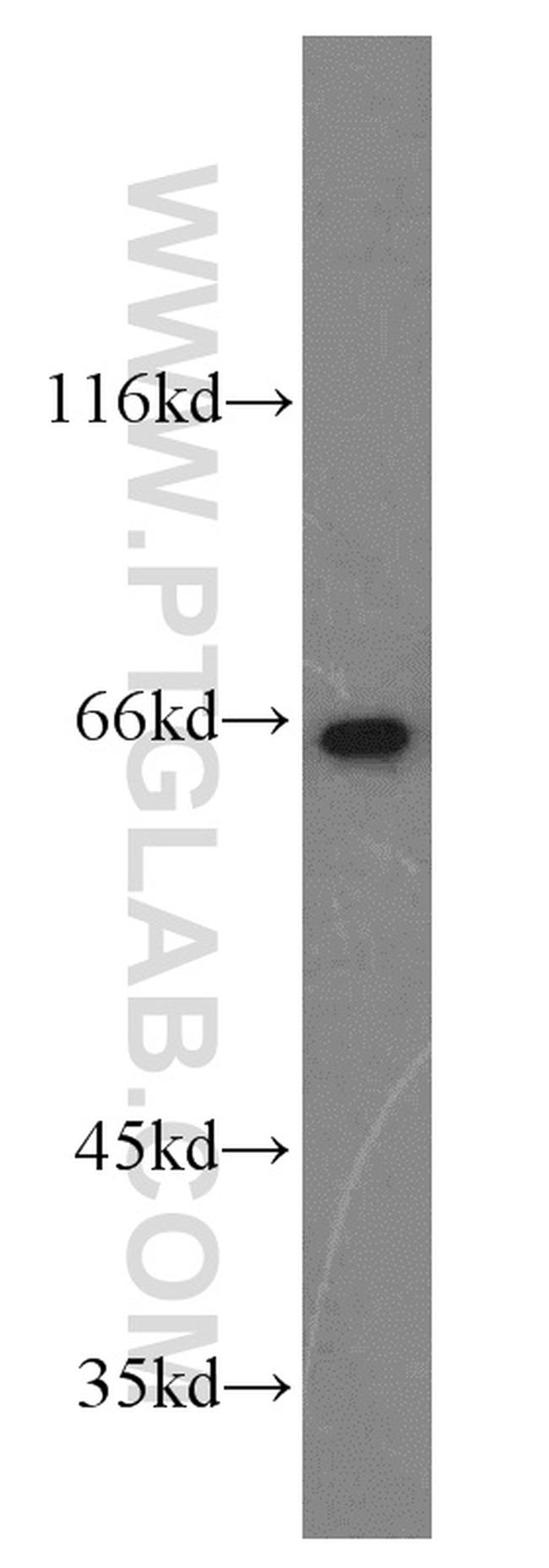 NFE2L1 Antibody in Western Blot (WB)