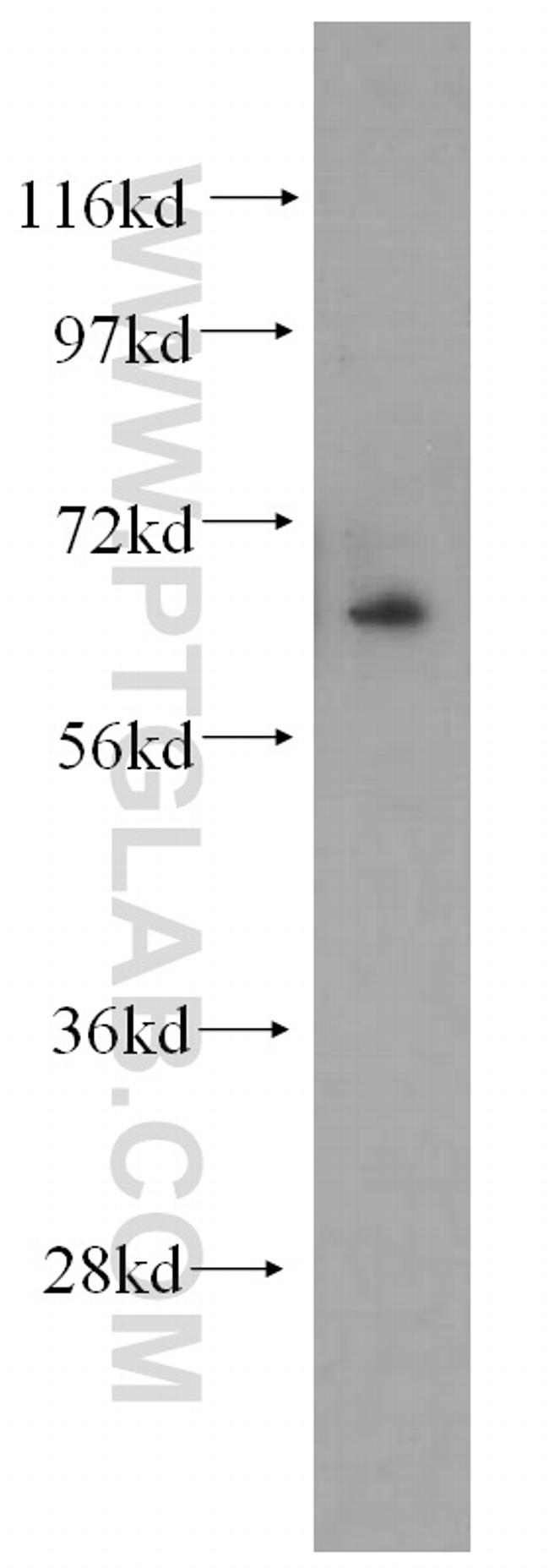 NFE2L1 Antibody in Western Blot (WB)