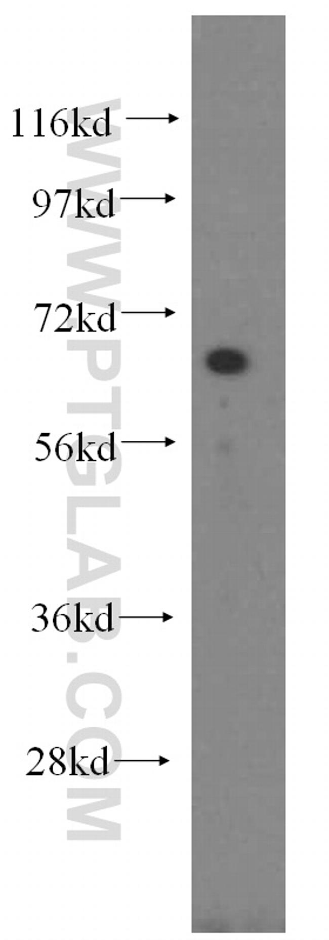 NFE2L1 Antibody in Western Blot (WB)