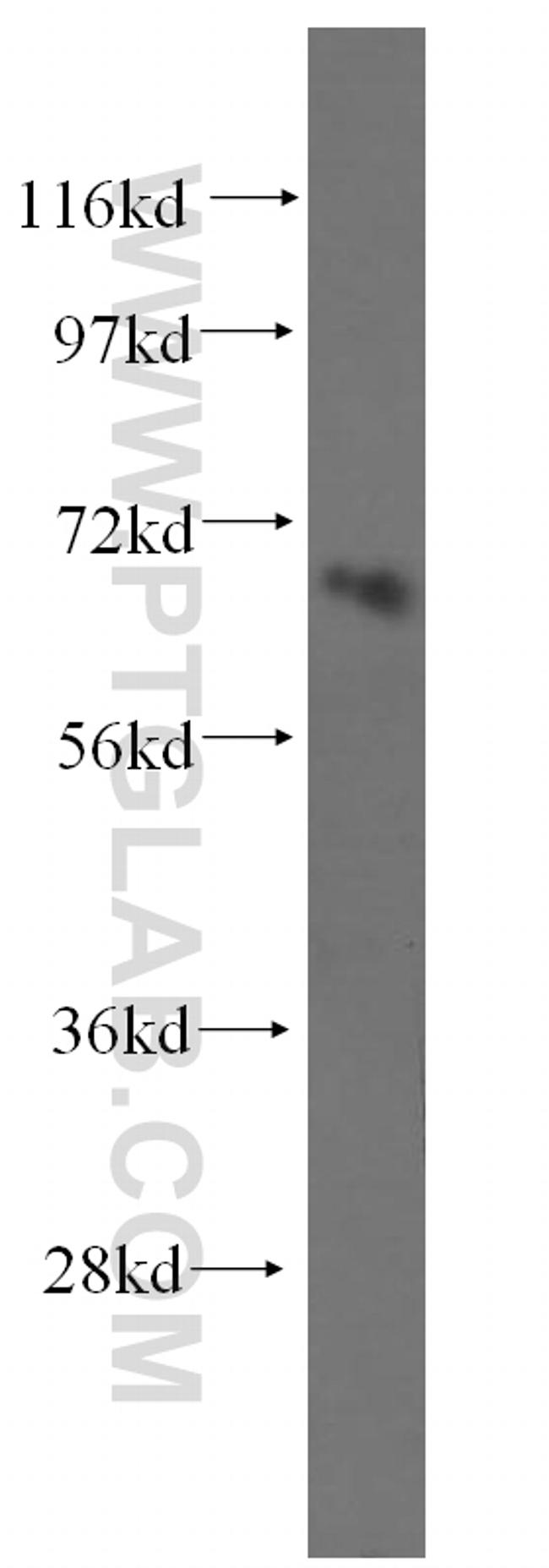 NFE2L1 Antibody in Western Blot (WB)
