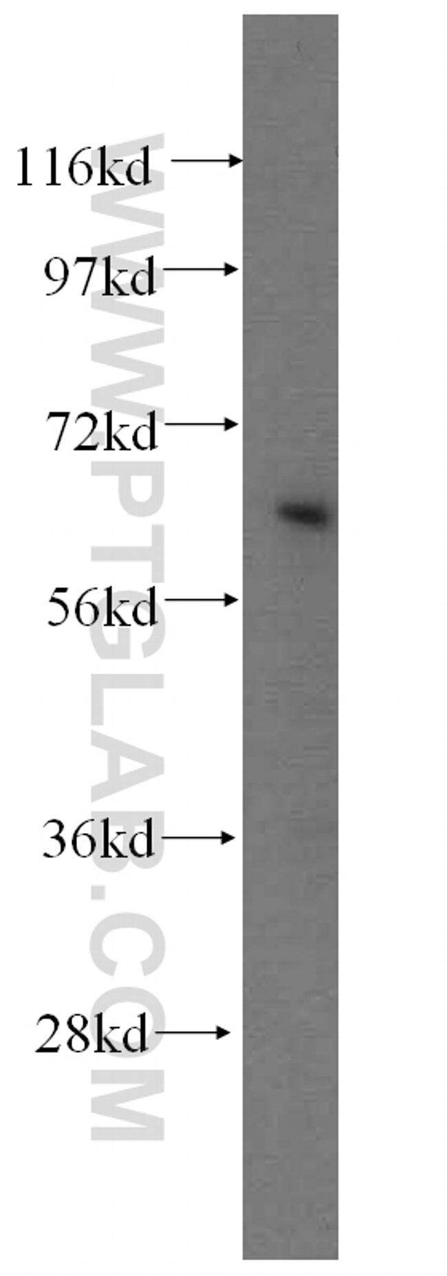 NFE2L1 Antibody in Western Blot (WB)