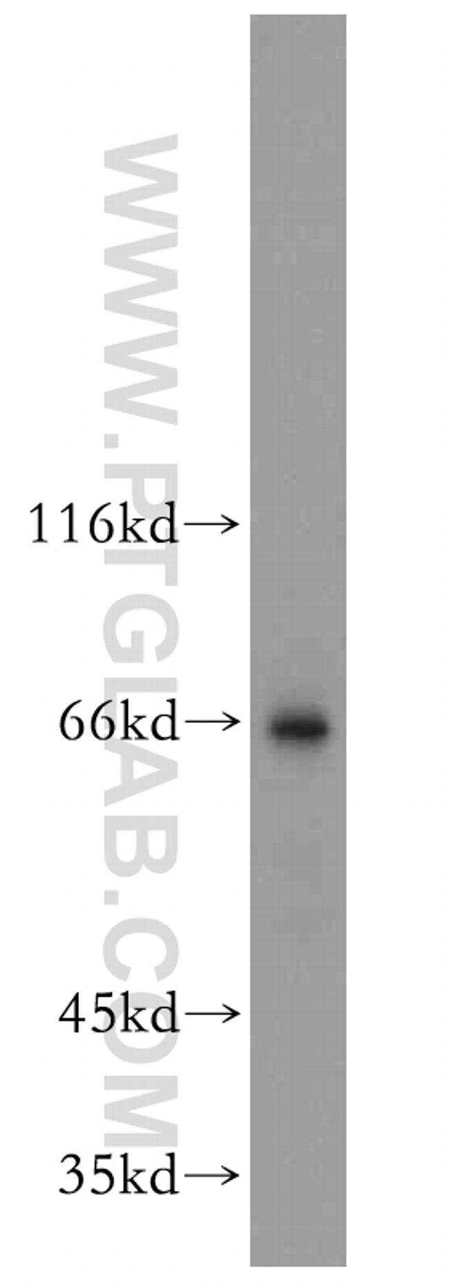 NFE2L1 Antibody in Western Blot (WB)