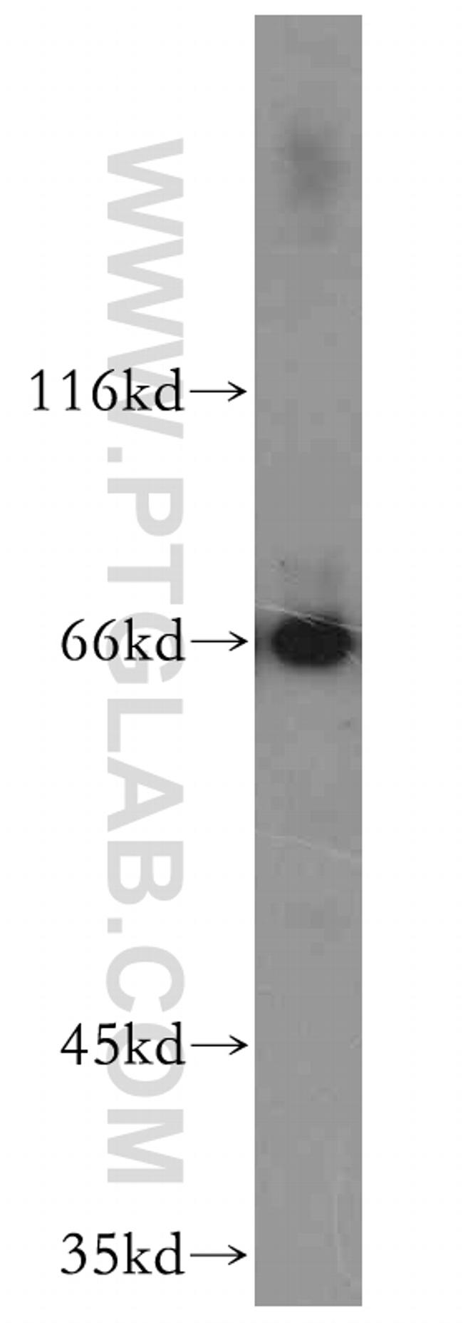 NFE2L1 Antibody in Western Blot (WB)