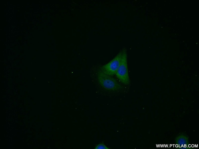 PSME2 Antibody in Immunocytochemistry (ICC/IF)