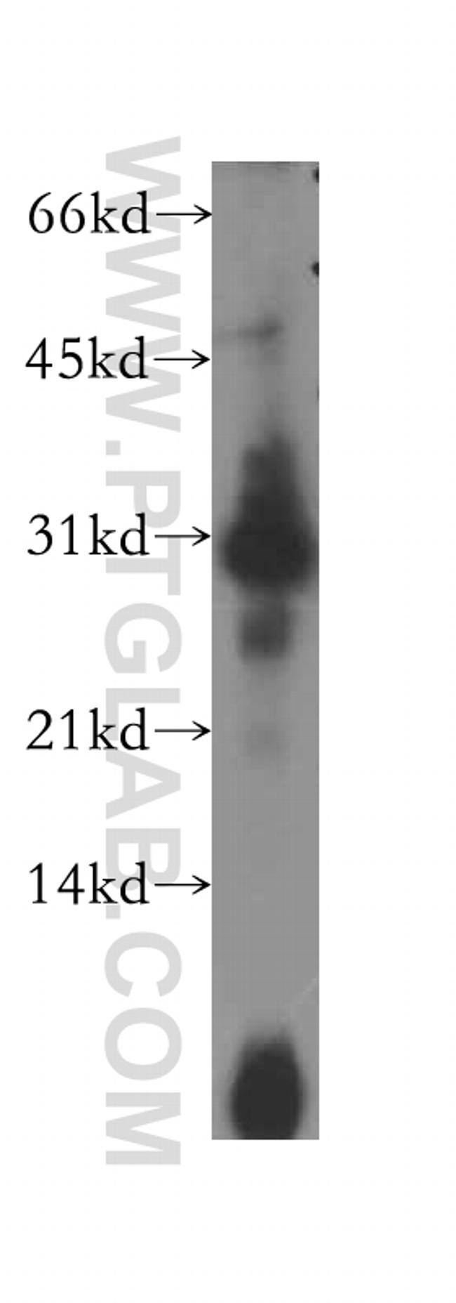 PSME2 Antibody in Western Blot (WB)